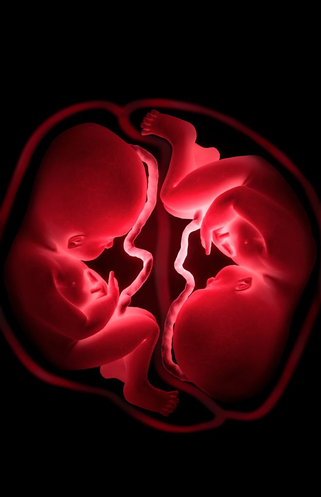 A conceptual image depicting a womb containing stylized twin fetus'.